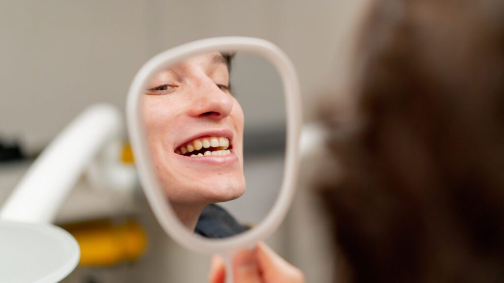 Frequently Asked Questions About Dental Veneers