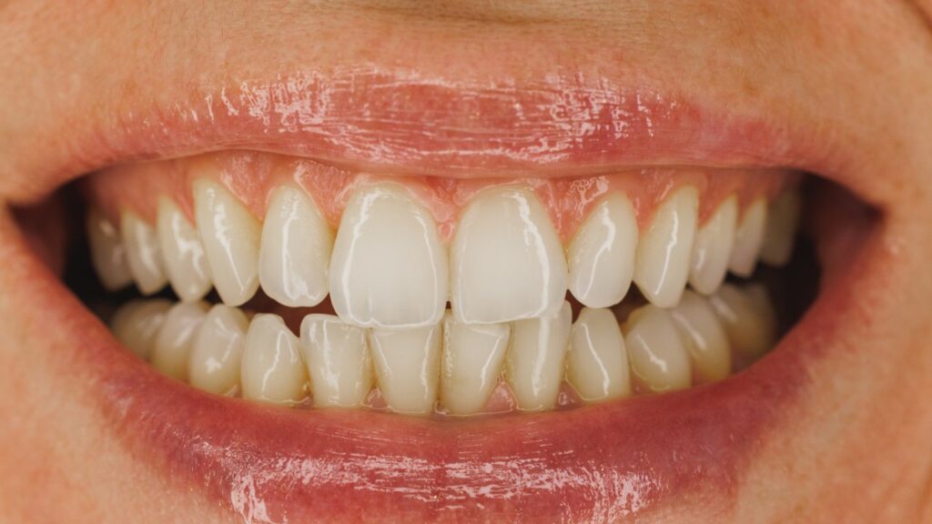 Cosmetic Dentists
