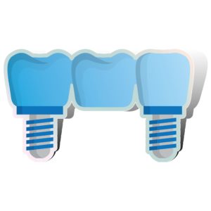 Is Your Mouth a Good Candidate for Dental Implants