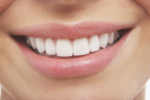 How Dental Lasers Can Improve Your Oral Health