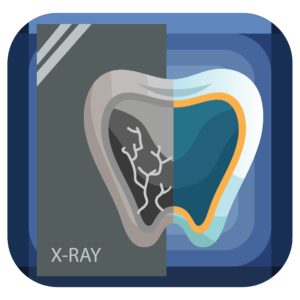 Why We Use Intra Oral Cameras to Improve Your Dental Care 