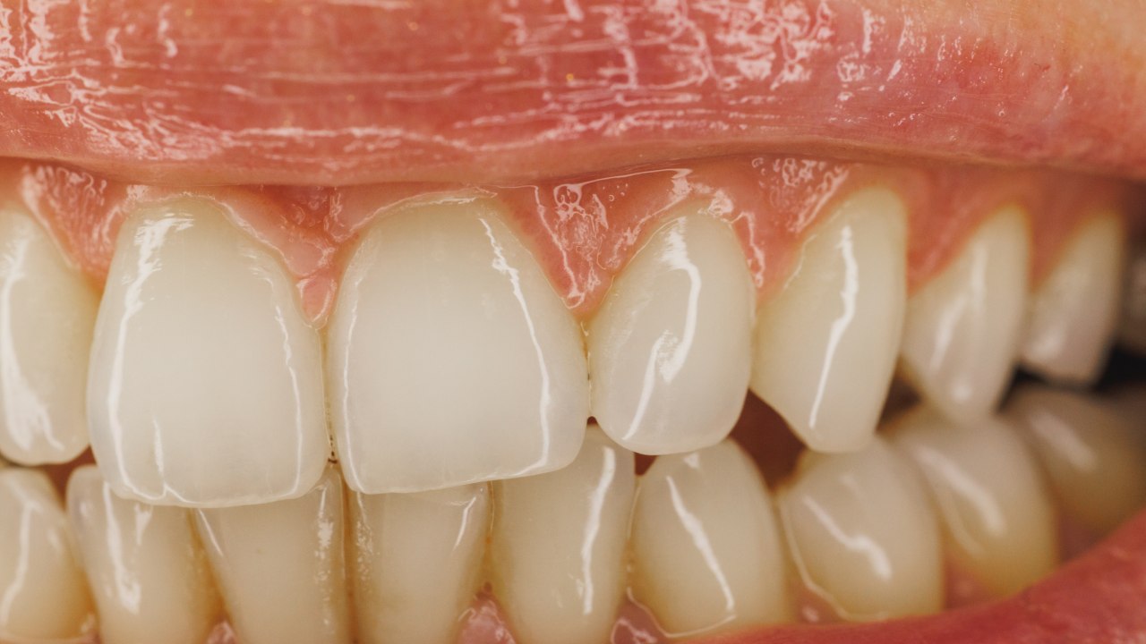 Having Fun with Toothpaste Flavors Can Make Brushing Easier