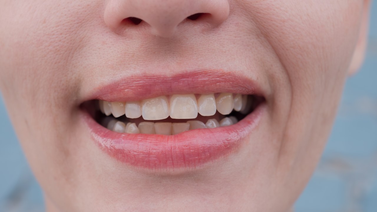 Sensitive Teeth
