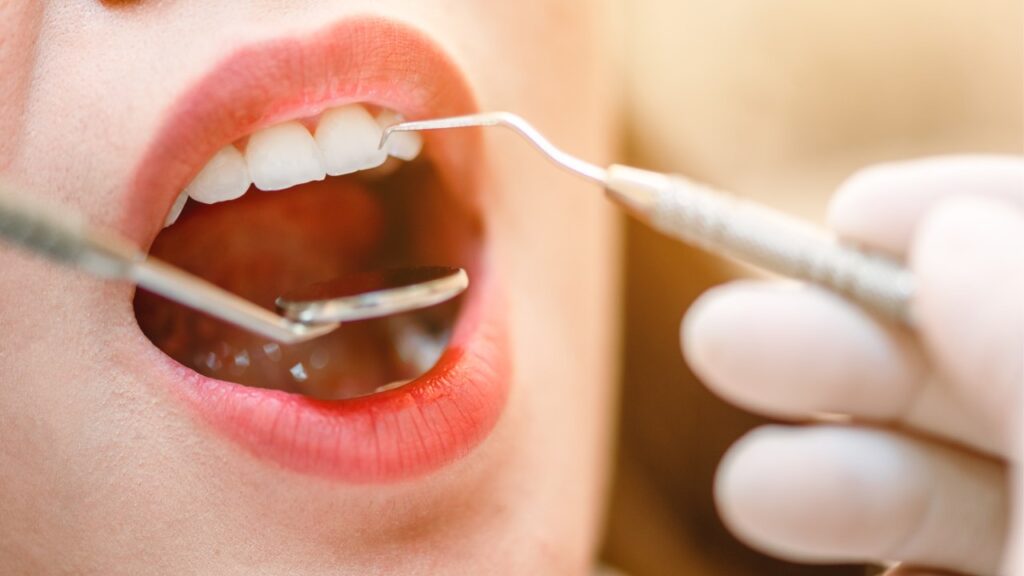 Warning Signs of Tooth Decay