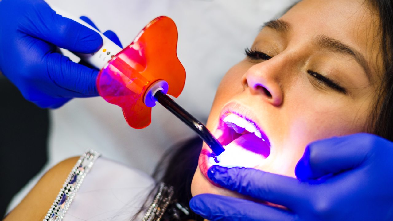 Zoom Whitening Treatment
