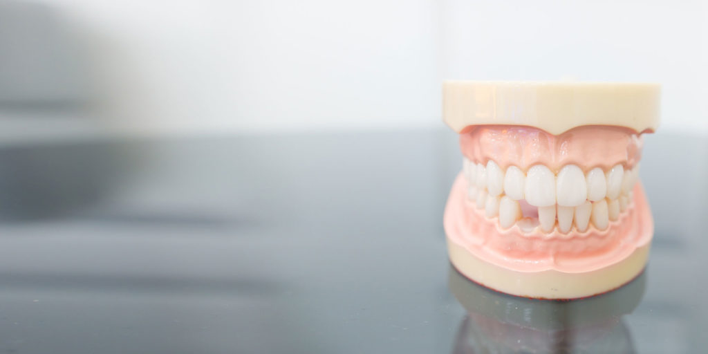 missing tooth model