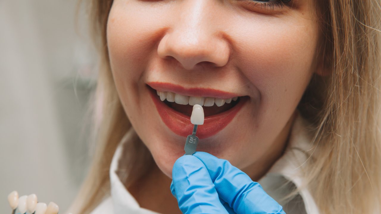 Can a Cosmetic Dentist Near Me Whiten My Teeth