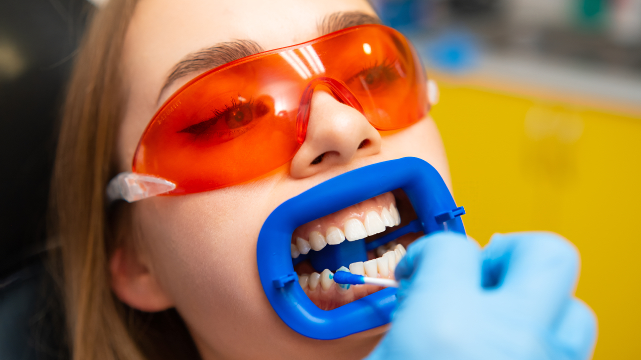 Dentist Near Me Whiten My Teeth