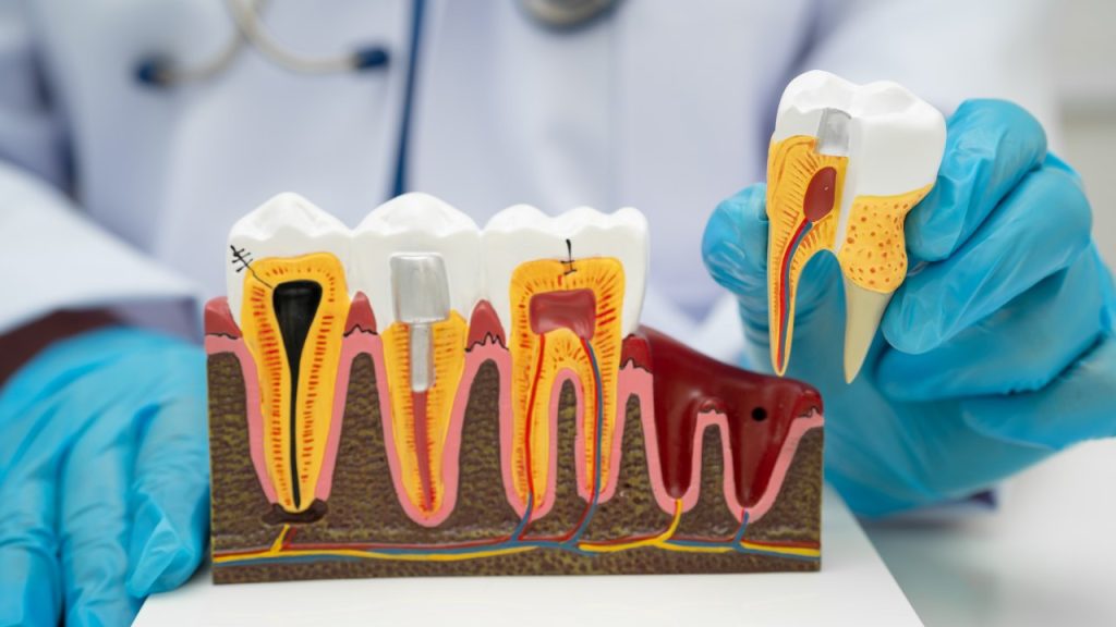 Gum Disease and Whole-Body Health