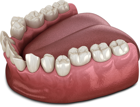 Problems Associated with Crooked Teeth