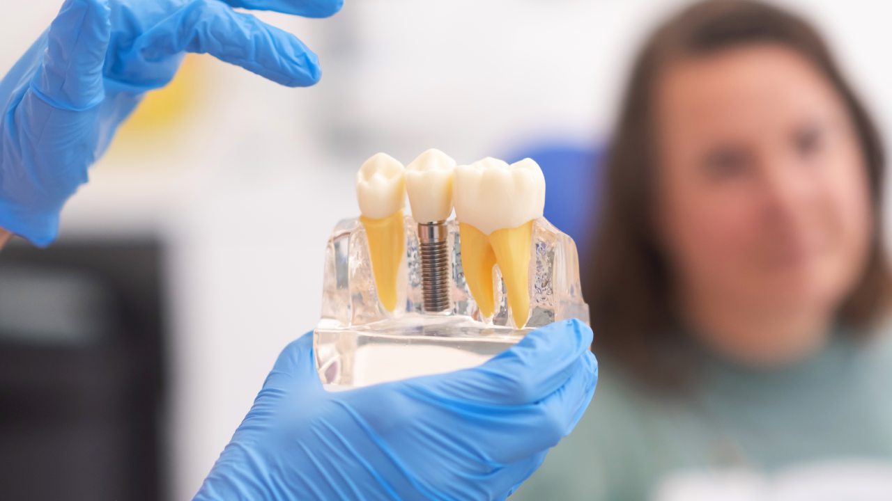 Bone Grafting Ridge Preservation: A Key to Dental Health