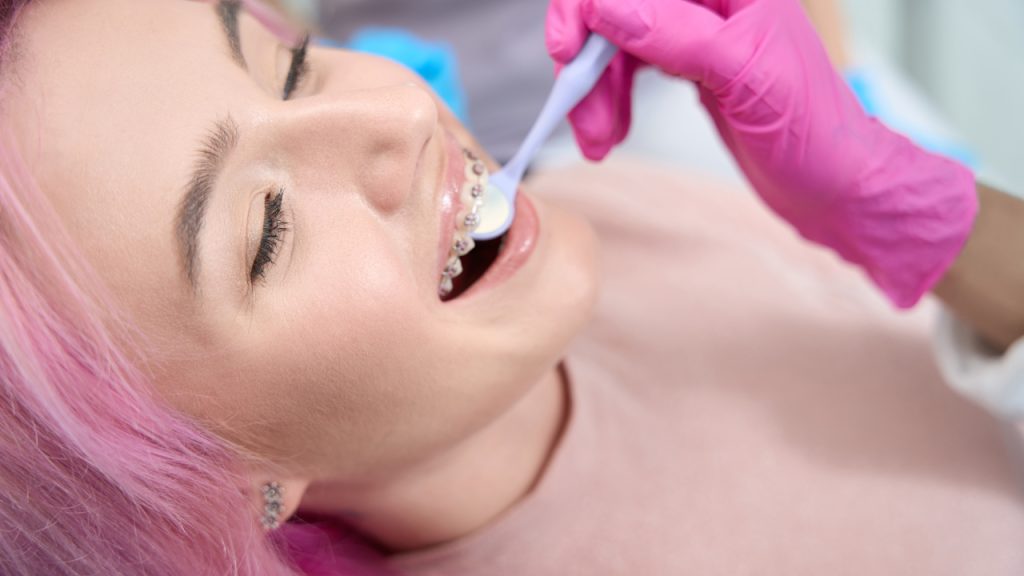 Cosmetic Bonding Service