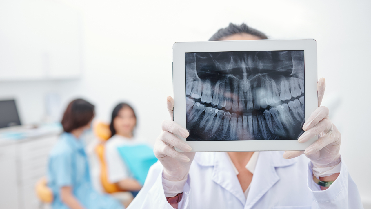 Digital Xray Imaging