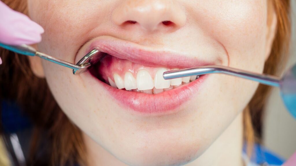 Get the Best Gum Disease Treatment for Lasting Results