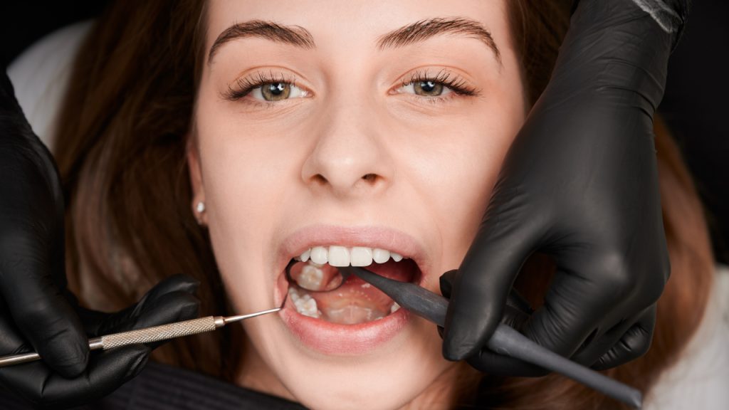 Guide to Lost Crown Repair