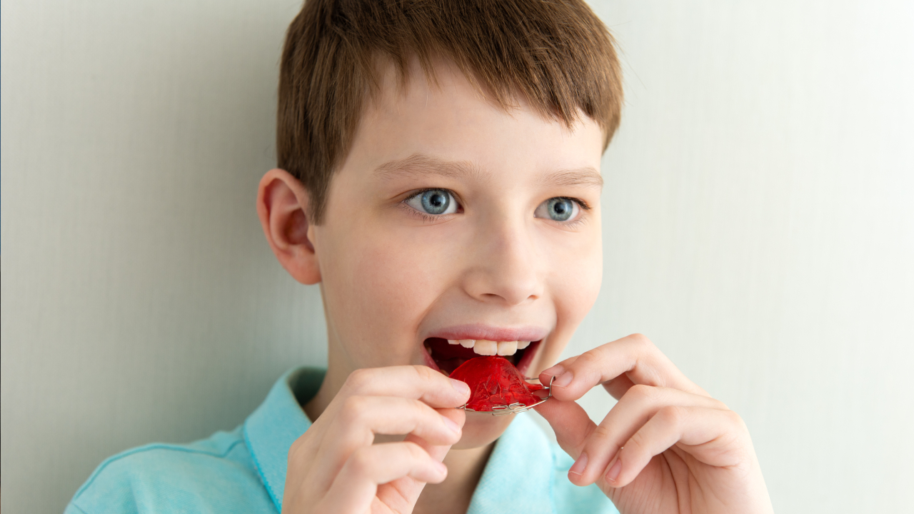 Palatal Expander Service