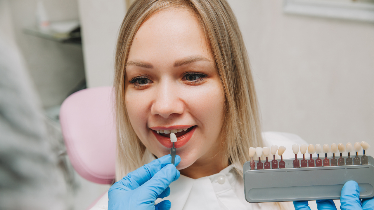 Porcelain Veneer Placement