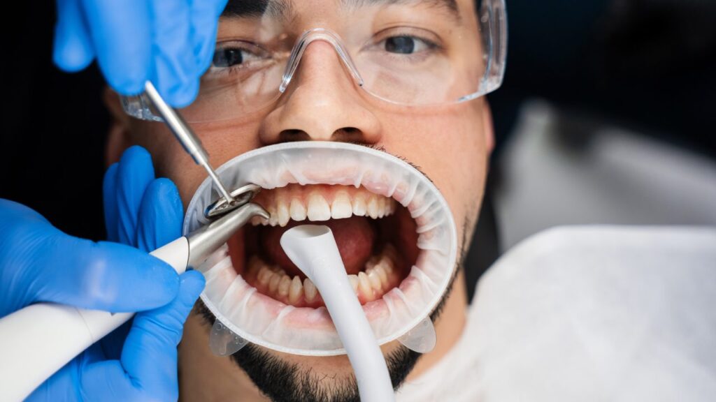 Why Your Routine Dental Checkup Is Essential for Health