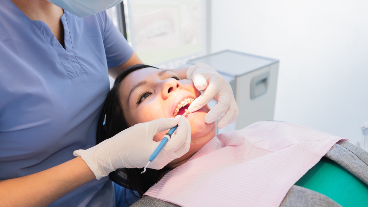 Elevate Your Smile with Americo Dental Veneer Providers