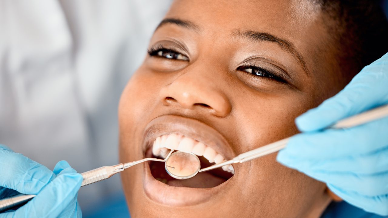 Elevate Your Smile with Blue Cross Blue Shield Dental Implant Coverage