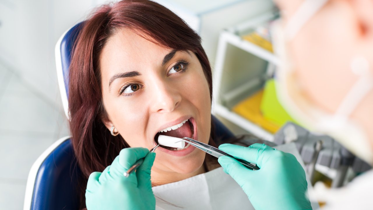 Maximize Your Benefits: MetLife Dental Restoration Services