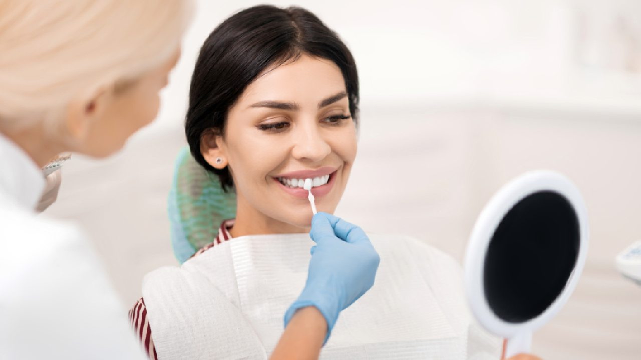 Maximize Your Coverage: Composite Veneers with Dental Insurance