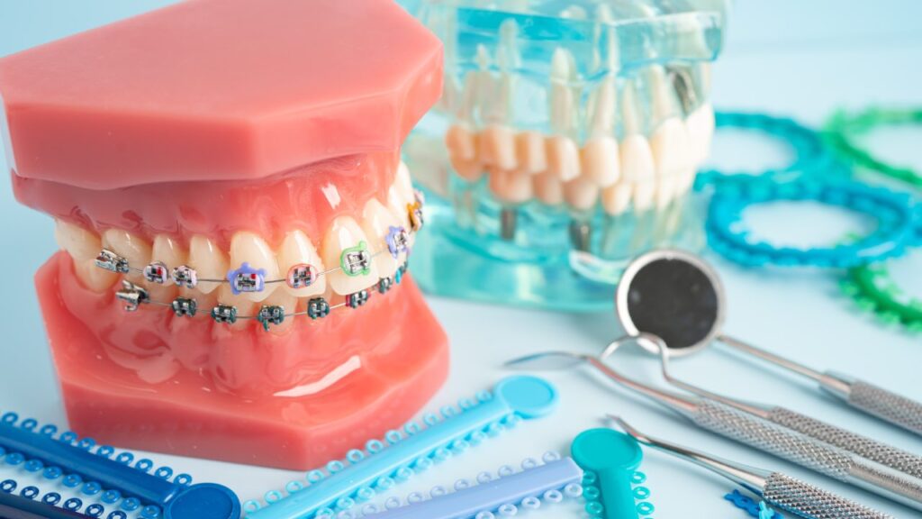 Sleep Apnea Dental Appliances: What’s the Success Rate