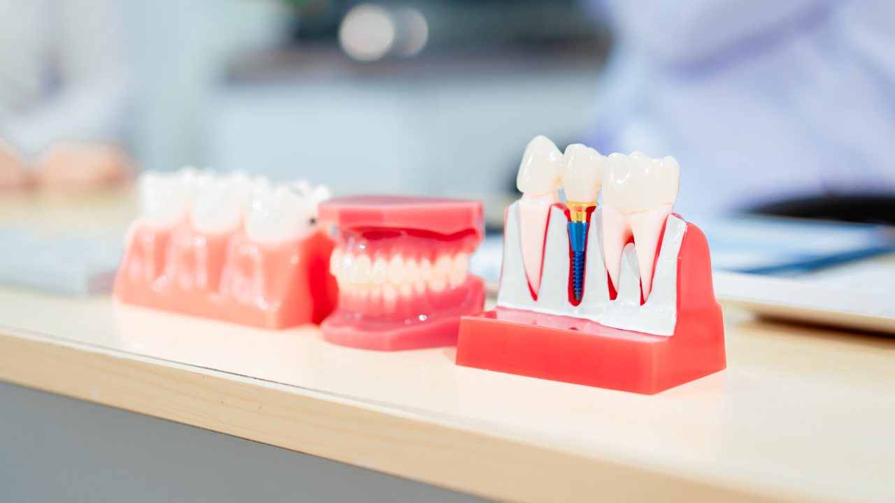 Transform Your Sleep with a Dental Device for Obstructive Sleep Apnea